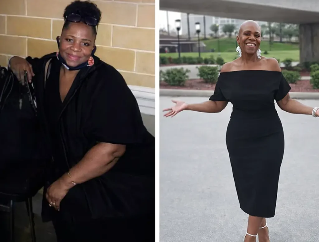 dr-bharmota-success-story-lisa-p